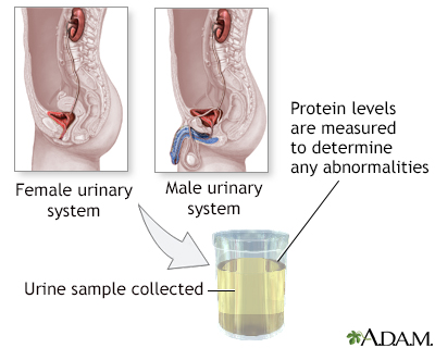 Mean change in levels of serum proteins, including total protein