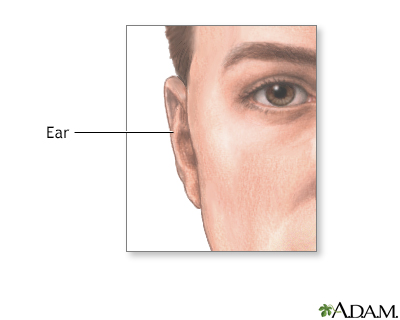 Ear protuberance - Illustration Thumbnail
                      