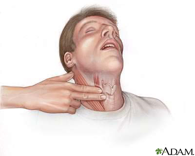 carotid pulse palpation