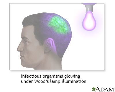Wood's lamp illumination - Illustration Thumbnail
              