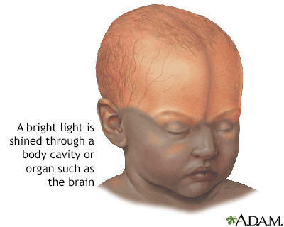 Infant brain test - Illustration Thumbnail
              