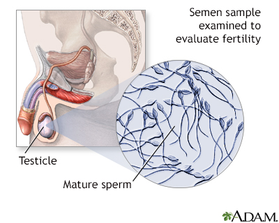 Semen analysis Information