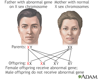 Sex Linked Recessive Information Mount Sinai New York