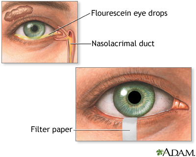 TEAR definition in American English