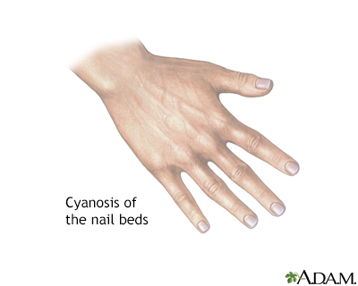 What Discoloration of the Nail Means | Nailpro