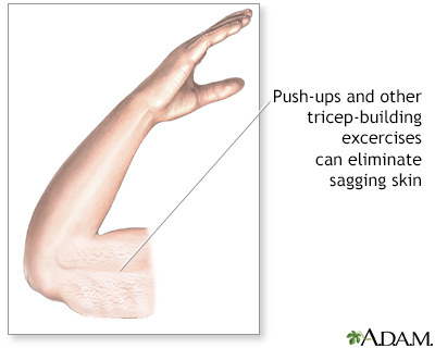 One of the BEST exercises to help strengthen and tighten your saggy ar, arm  workout