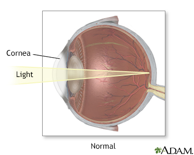 Normal vision - Illustration Thumbnail
                      