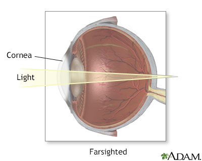 Farsighted - Illustration Thumbnail
                      