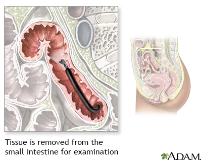 Small intestine tissue sample - Illustration Thumbnail
                      