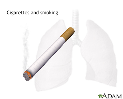 Dangers du tabagisme