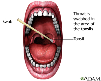 normal throat bumps