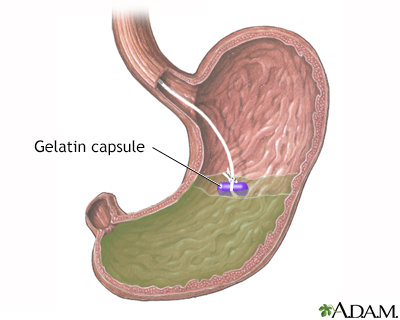Gelatin capsule in stomach - Illustration Thumbnail
              
