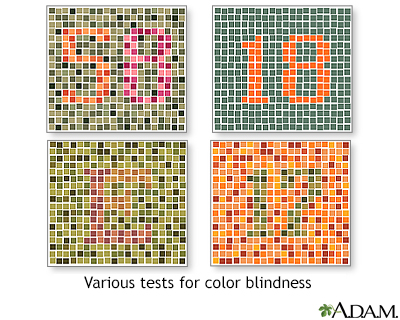 Color Blind Test for Kids - For 1 to 15 Years Old