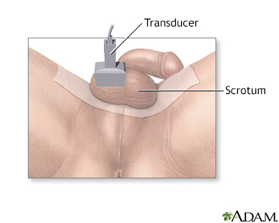 Testicular ultrasound - Illustration Thumbnail              