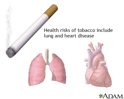 Tobacco health risks - Illustration Thumbnail              