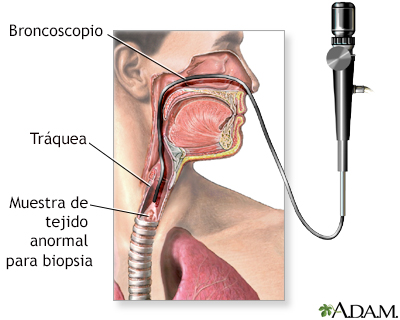 Examen de las vías respiratorias superiores - Miniatura de ilustración
              