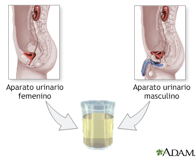 Examen de orina