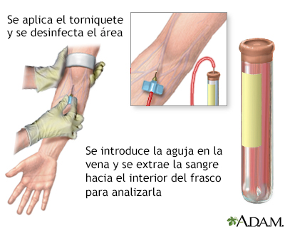 Prueba de GCH cuantitativa en sangre