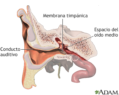 Inserción de un tubo en el oído - serie - Anatomía normal - Miniatura de presentación
              
