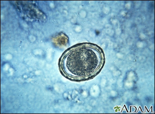 Huevos de oxiuros - ascariosis - Miniatura de ilustración
              