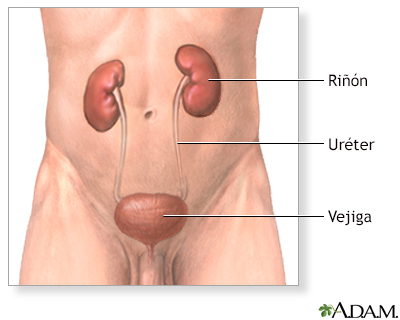 Extirpación quirúrgica del riñón (nefrectomía) - serie - Miniatura de presentación
              