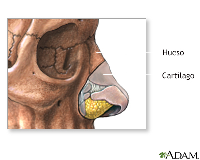 Cirugía plástica de la nariz (rinoplastia) - serie - Miniatura de presentación
              