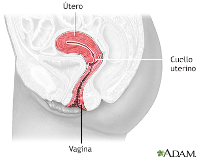 Displasia cervical - serie