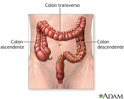 Resección del intestino grueso - serie - Miniatura de presentación
              