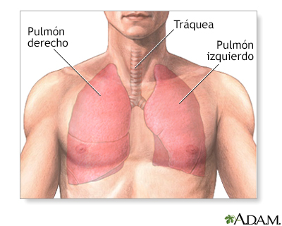 Lobectomía pulmonar - serie - Anatomía normal - Miniatura de presentación
              