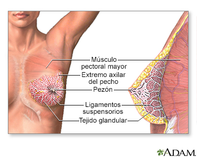 Papiloma seno. Papiloma intraductal de mama causas - soaptele.ro Papiloma ductal de seno