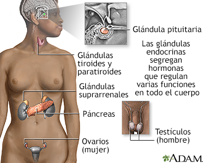 niños con sindrome de cushing