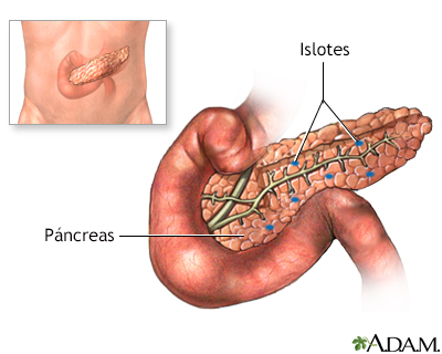 Trasplante de páncreas - serie - Miniatura de presentación
              
