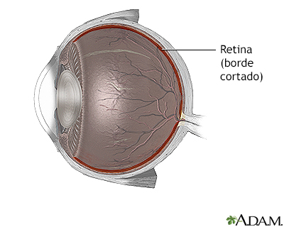 Desprendimiento de retina - anatomía normal