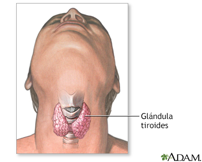 Tiroidectomía - Serie - Miniatura de presentación
              