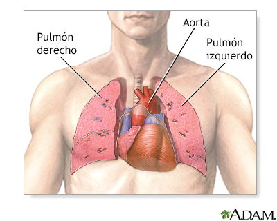 Trasplante de corazón y pulmón - serie - Anatomia normal - Miniatura de presentación
              