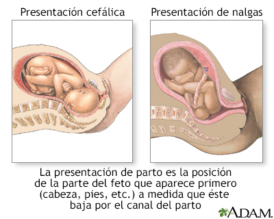 Presentaciones de parto - Miniatura de ilustración
              