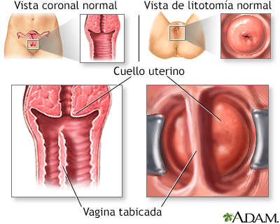 Trastornos en el desarrollo de la vagina y la vulva