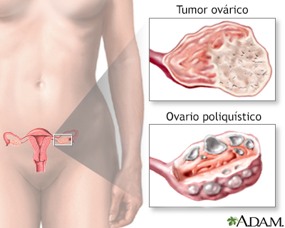 Abdomen externo normal: MedlinePlus enciclopedia médica illustración
