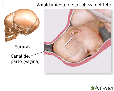 Moldeamiento de la cabeza fetal - Miniatura de ilustración
              