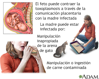 Toxoplasmosis congénita