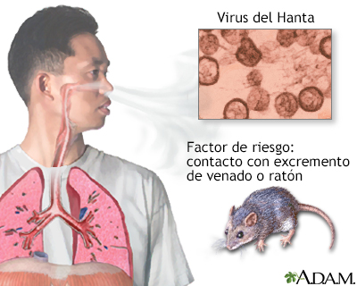 Virus Hanta - Miniatura de ilustración
              