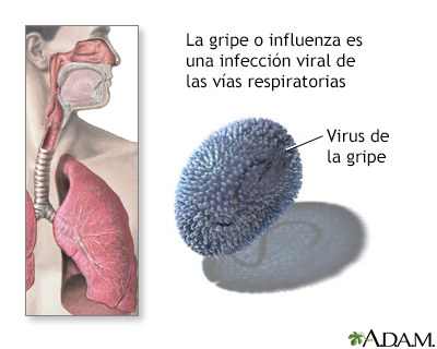Influenza - Miniatura de ilustración
              