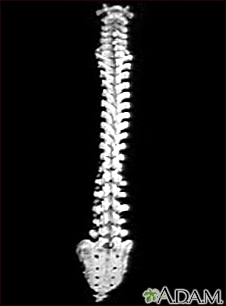 Columna vertebral - Miniatura de ilustración
              