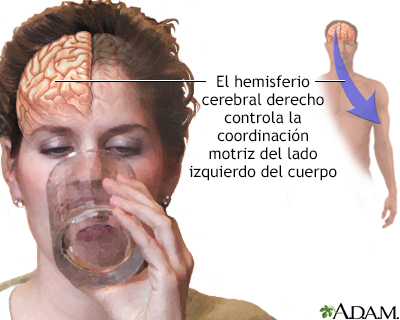 Función del hemisferio cerebral derecho - Miniatura de ilustración
              
