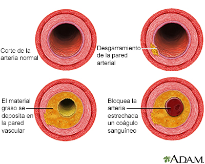 Abdomen externo normal: MedlinePlus enciclopedia médica illustración