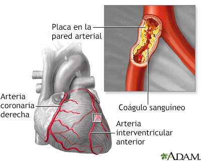 La fibra protege tus arterias para evitar enfermedades del corazón
