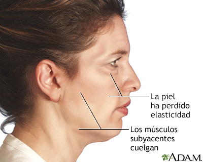 Cirugía estética facial - Serie - Indicaciones