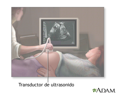 Ecografía prenatal - serie - Procedimiento (primera parte) - Miniatura de presentación
              