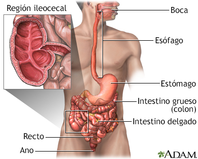 Enfermedad de Crohn - áreas afectadas - Miniatura de ilustración
              