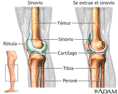 Articulación de la rodilla - Miniatura de ilustración
              